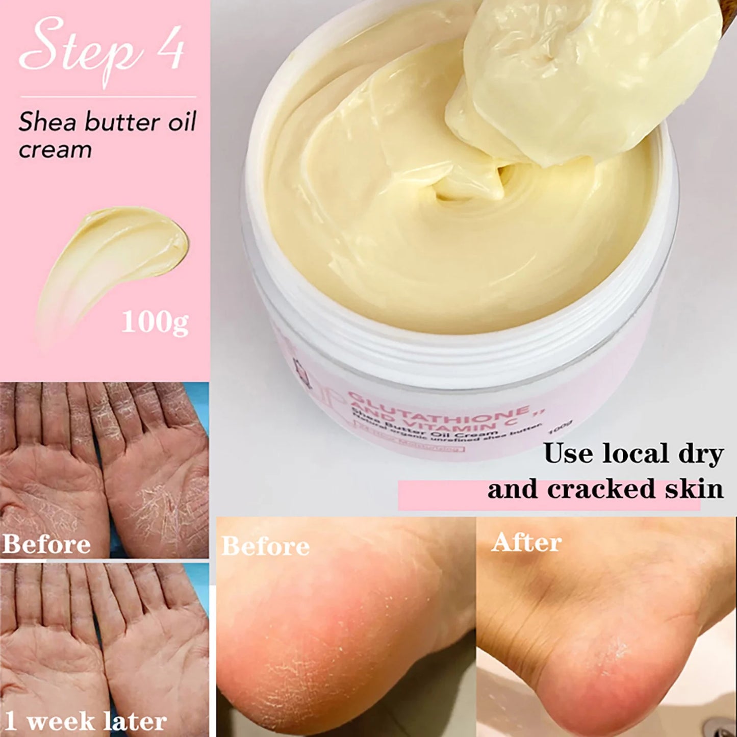 AILKE Whitening Facial Skin Care Lotion With Vitamin C Glutathione